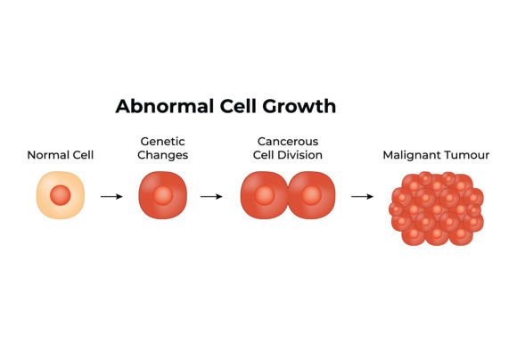 Download Abnormal Cell Growth Science Design - Growth Collection